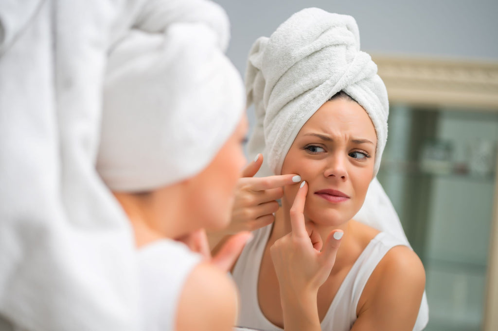 Why People With Acne & Sensitive Skin Should Stop Using Towels